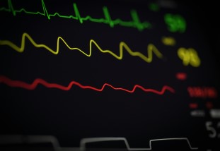 A close-up of an heartrate monitor.