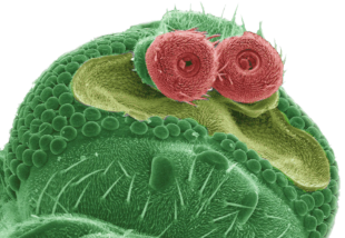 Microscope slide of bacteria